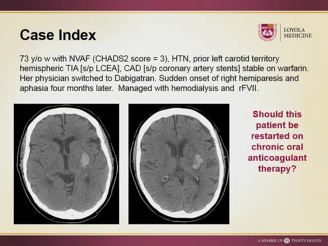 Special Cases in Acute Stroke Challenging the Norm