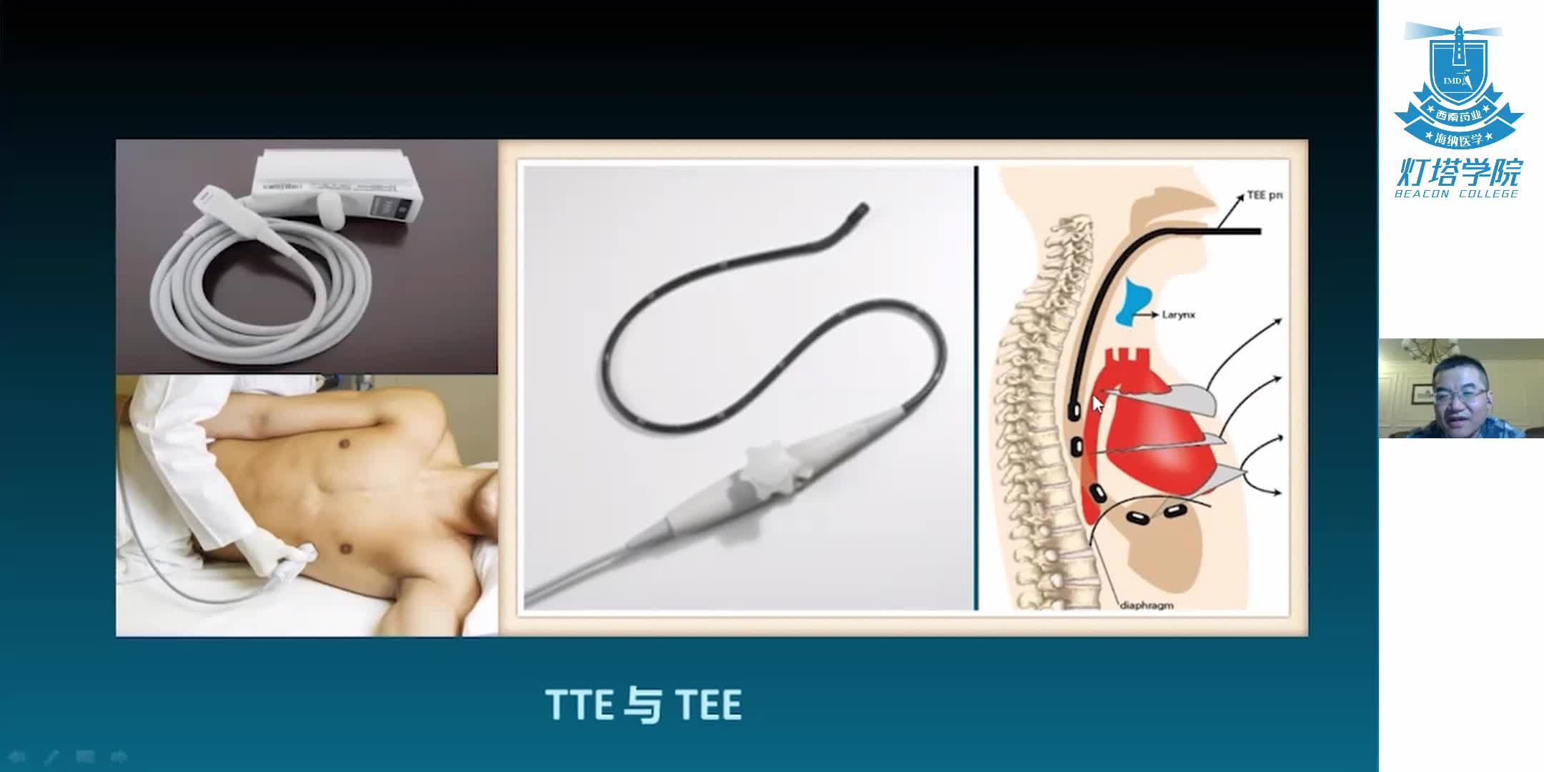 全面解析超声在心脏评估中的应用