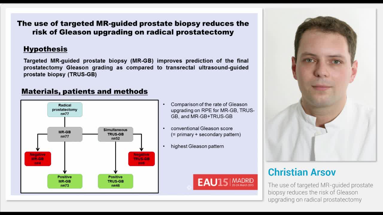 The use of targeted MR-guided prostate biopsy reduces the..-