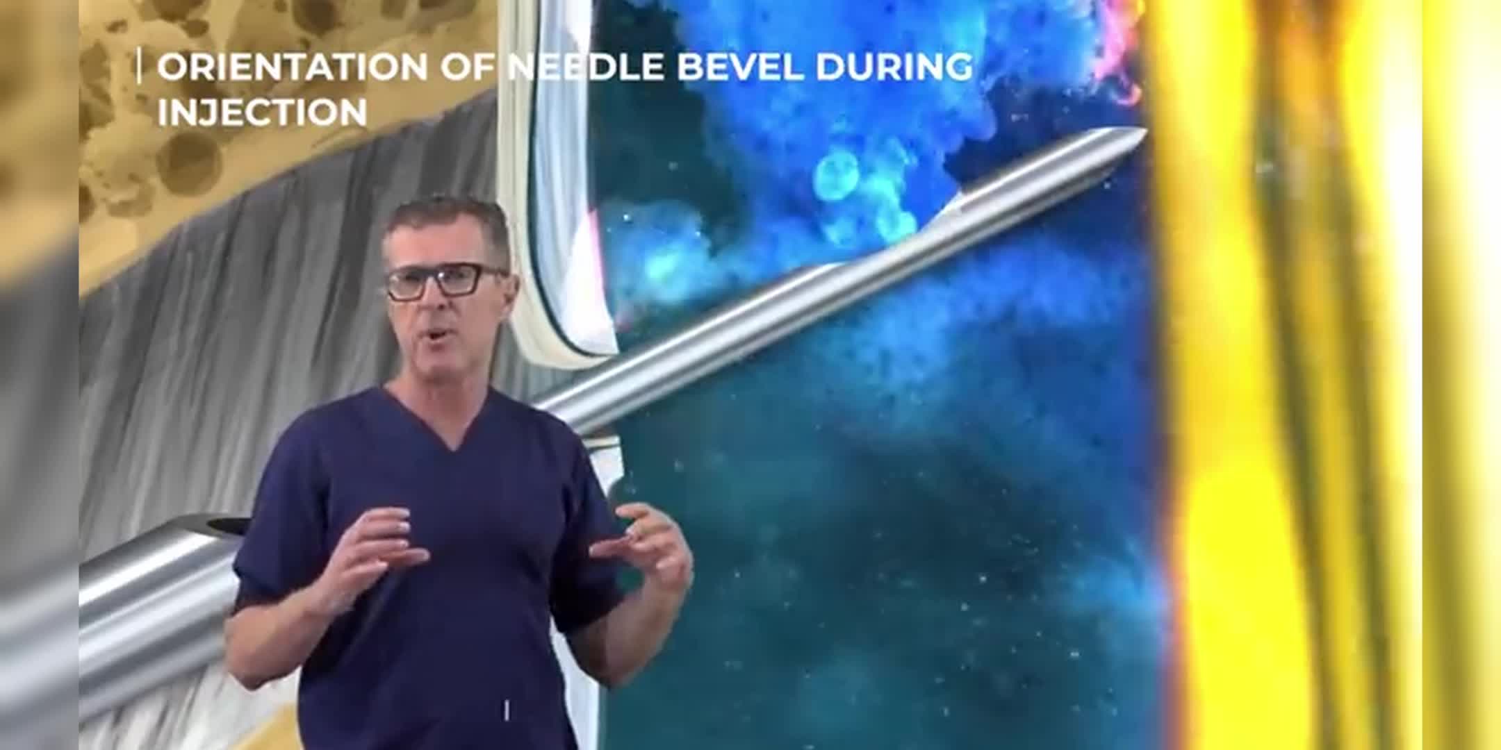 脊椎麻醉技术详解