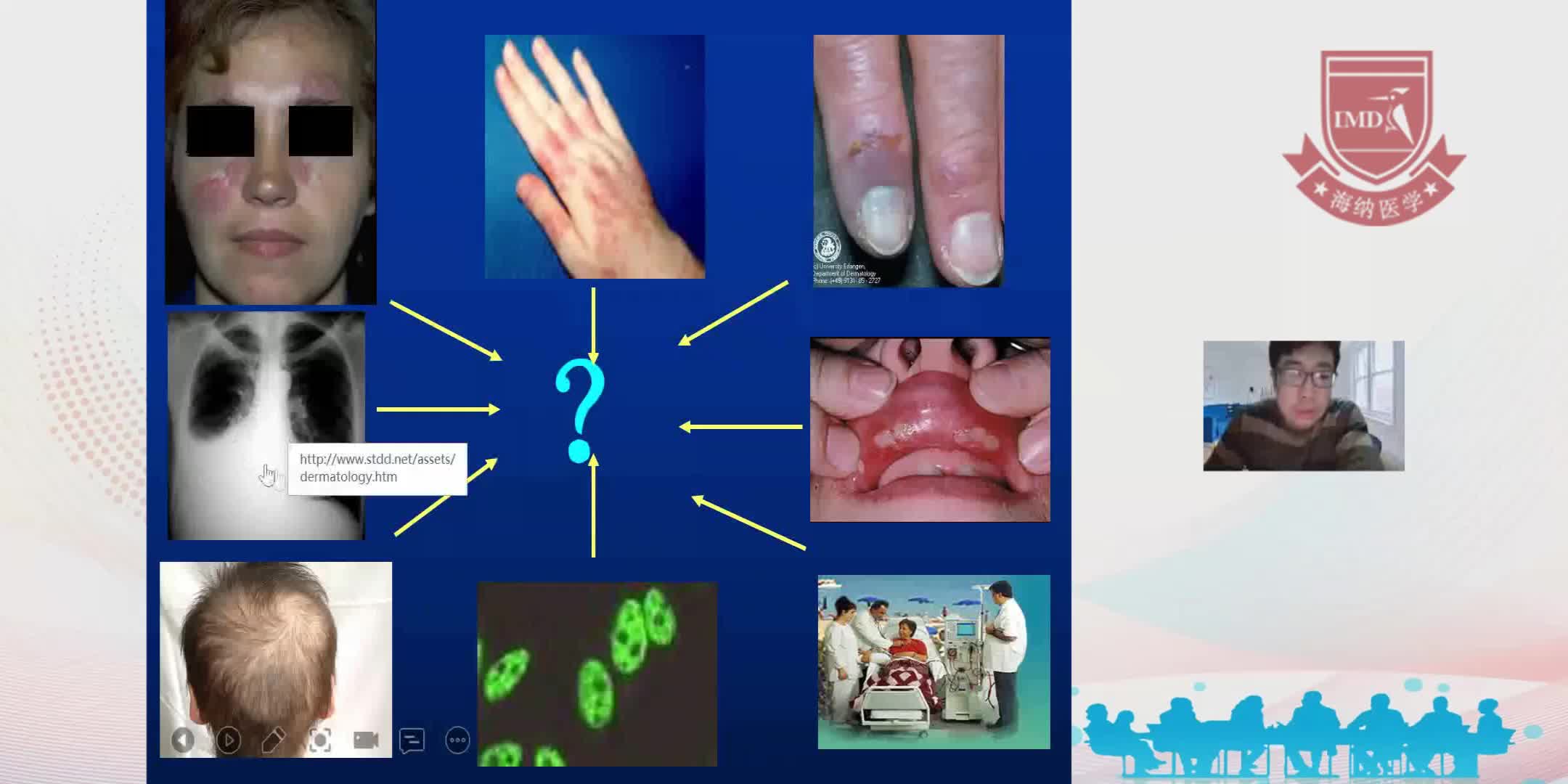 赵阳-风湿病的诊治进展