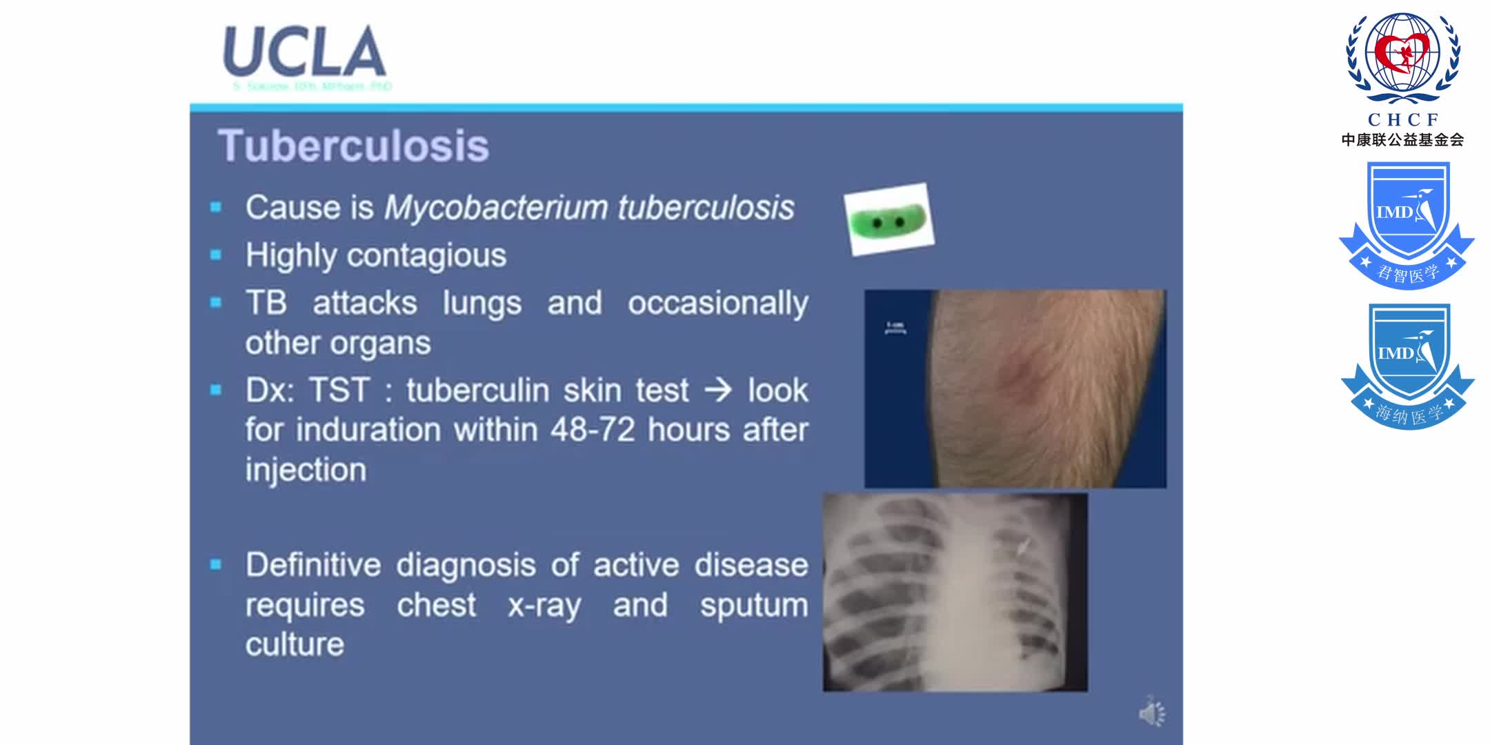 Anti-TB and antiviral  pharmacology_ HSV and Hepatitis C 1-1