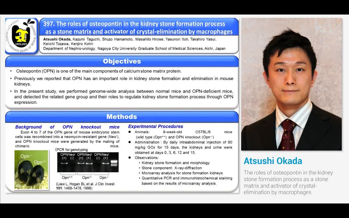 The roles of osteopontin in the kidney stone formation pr..-