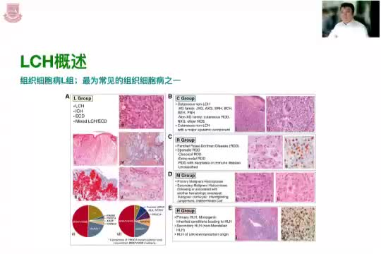 李剑-我如何治疗成人朗格汉斯细胞组织细胞增多症
