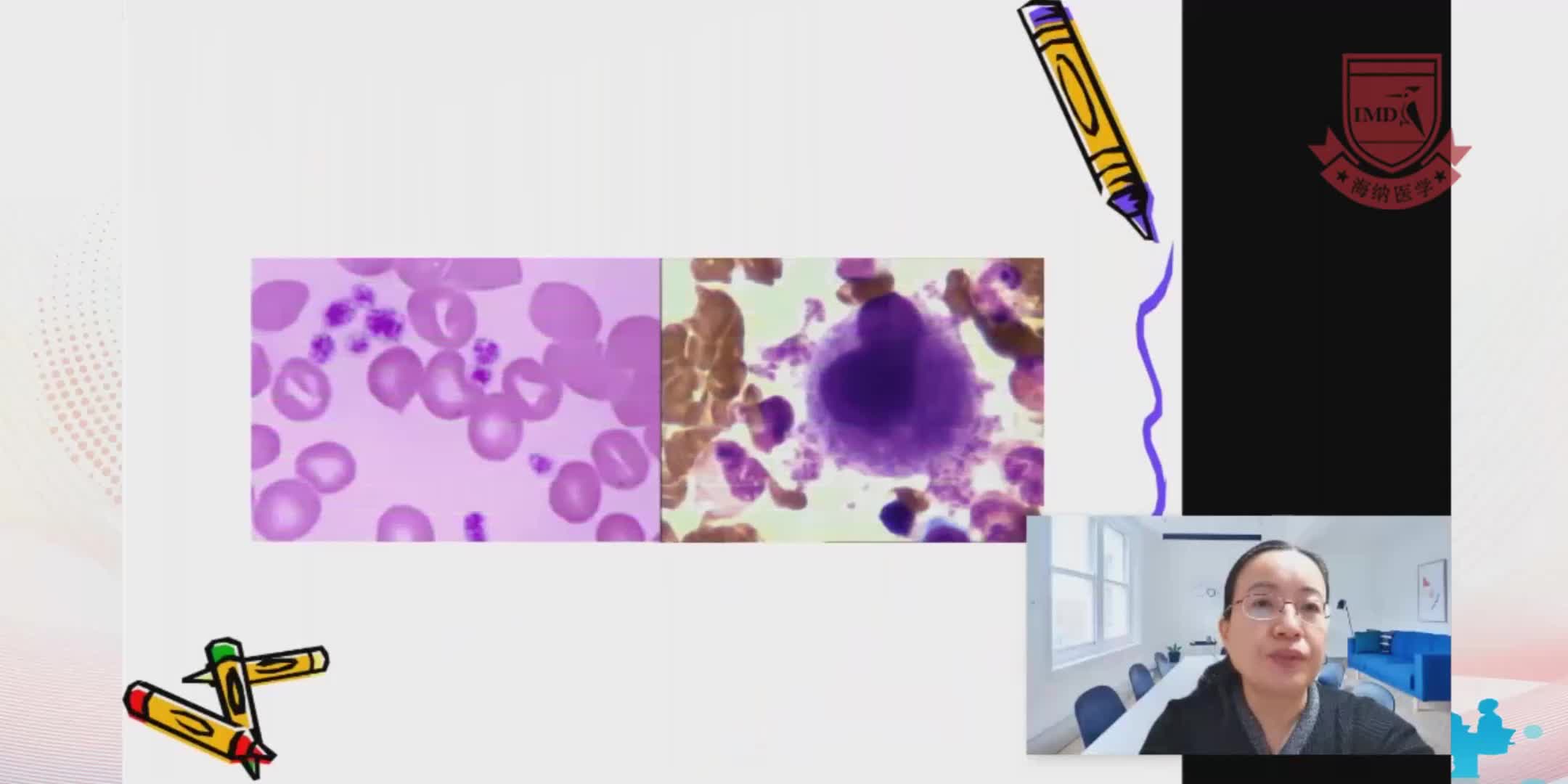 牛志云---血小板减少的原因