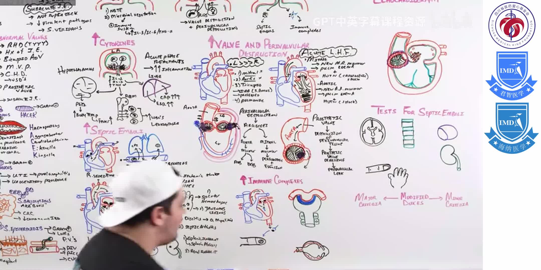 Infective Endocarditis 7