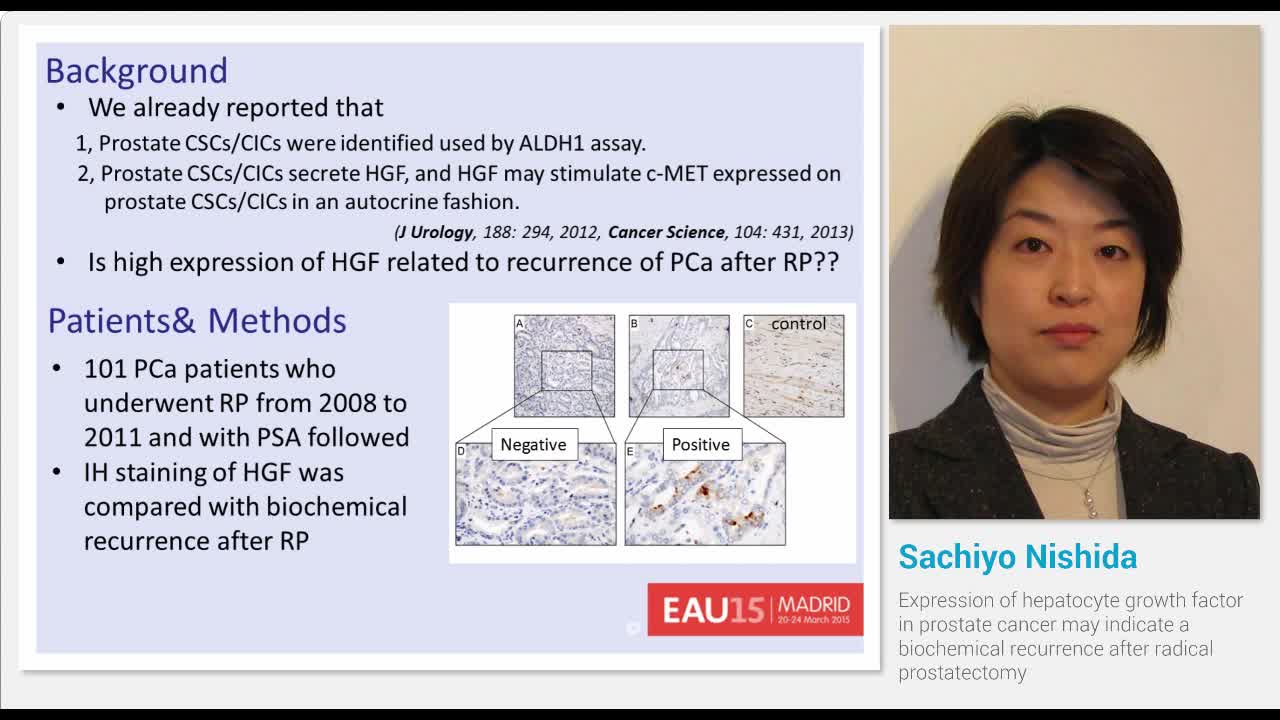 Expression of hepatocyte growth factor in prostate cancer..-