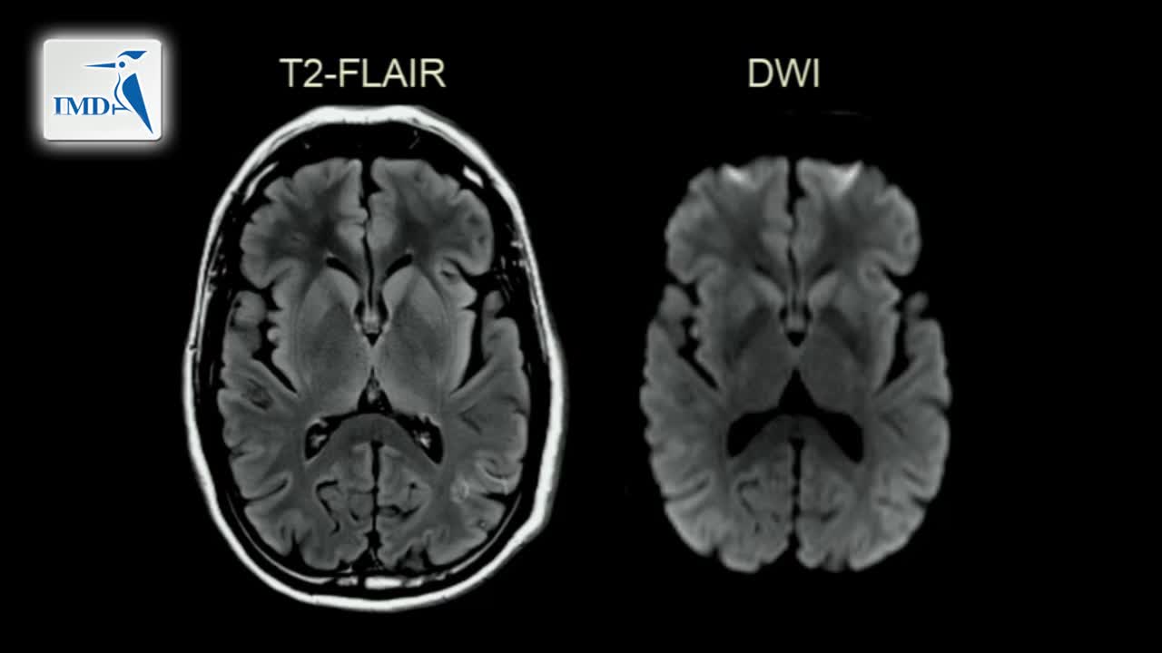 《神经科》2019年第1讲（总第156讲）基于病例学习神经影像学（1）