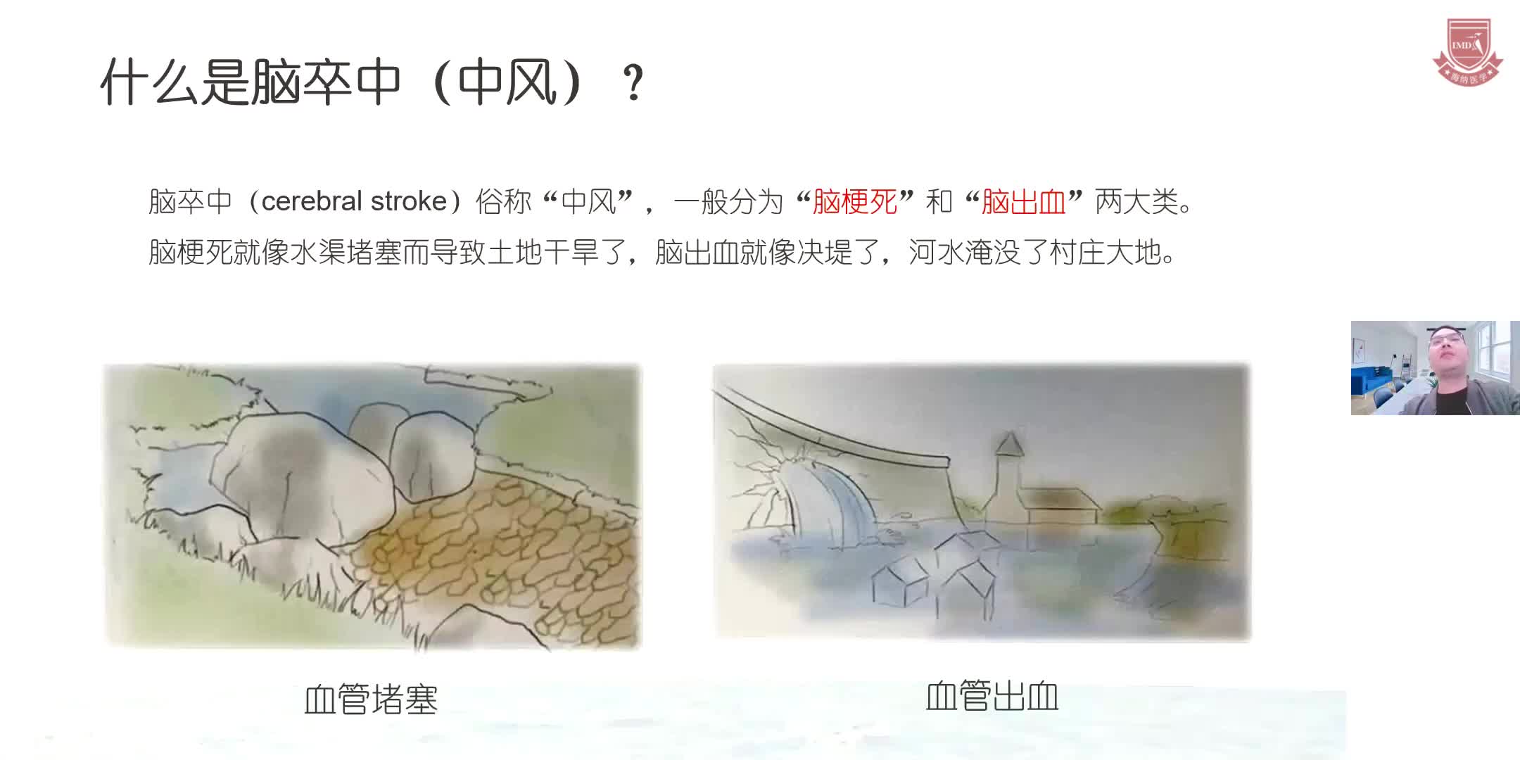 李成国-脑卒中全程健康管理