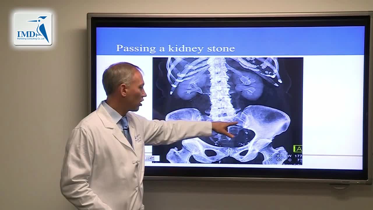 治疗肾结石的最新进步和发展（3）