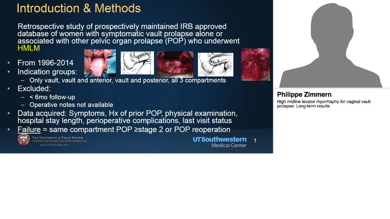 High midline levator myorrhaphy for vaginal vault prolaps-