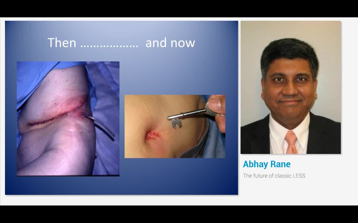 The future of classic LESS