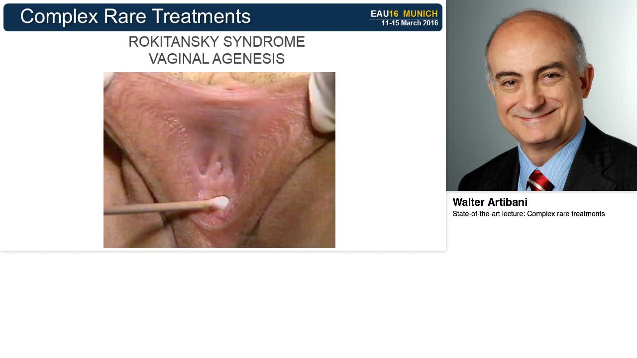 Complex rare treatments