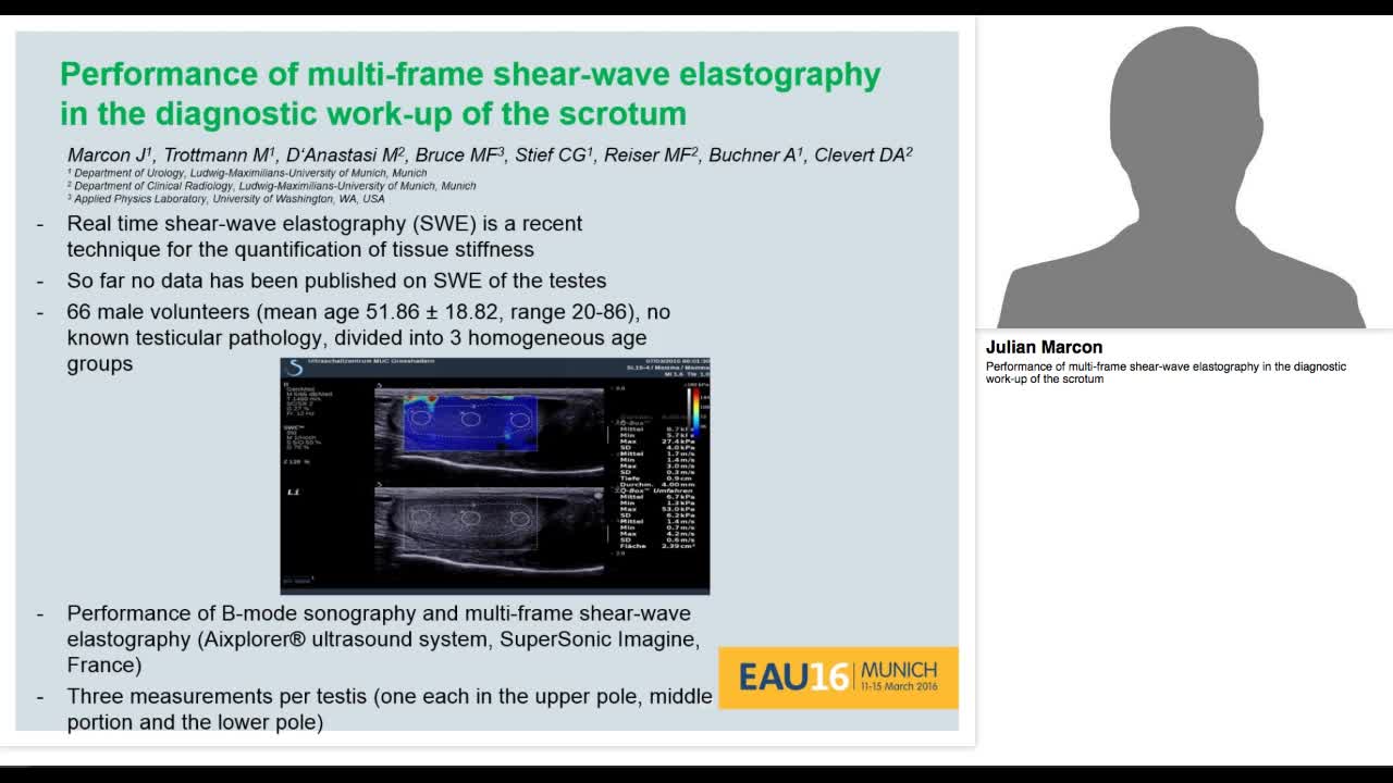 Performance of multi-frame shear-wave elastography in the-