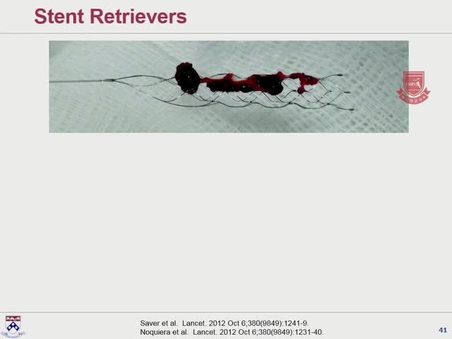 急性卒中的争议5