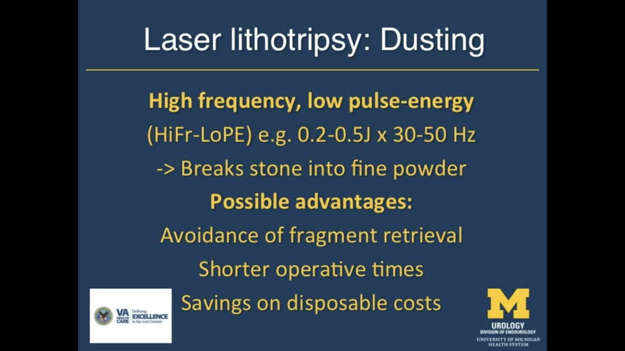 The new stone age, Ureteroscopic stone Dusting'' with a 12..-