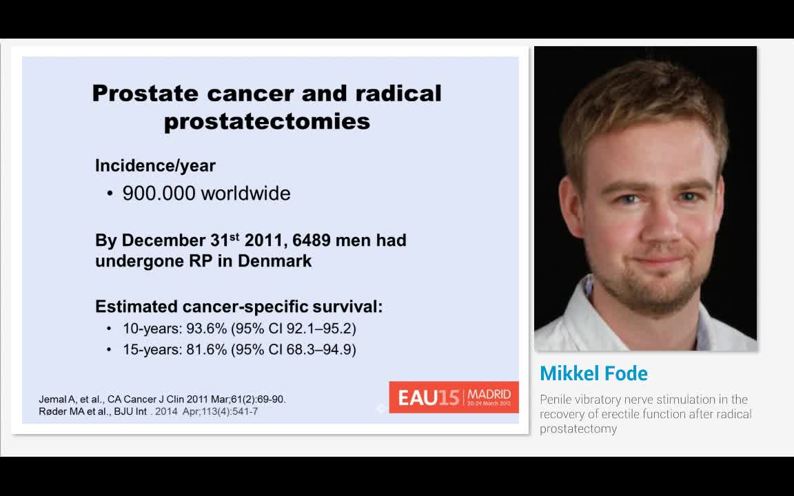 阴茎振动神经刺激治疗射精障碍