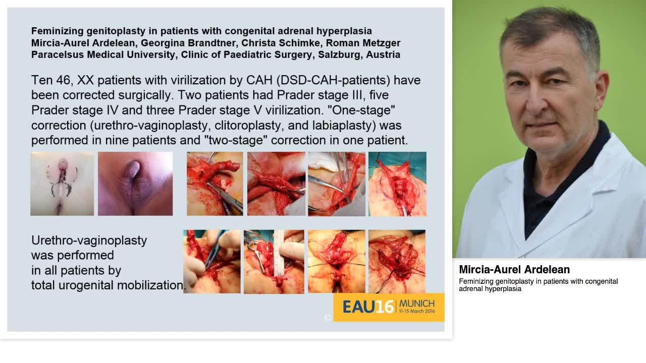 Feminizing genitoplasty in patients with congenital adren-