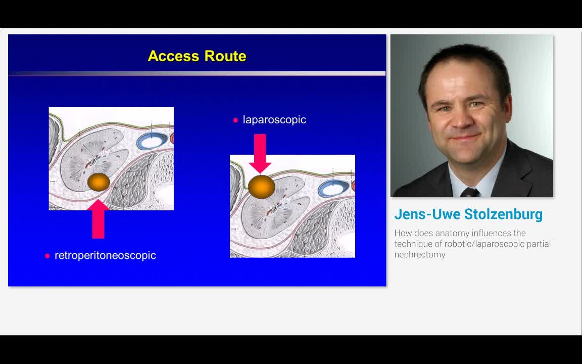 How does anatomy influences the technique of robotic-lapa..-
