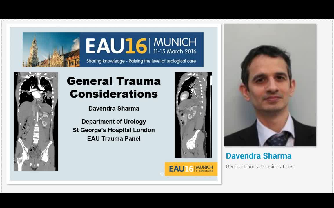 General trauma considerations