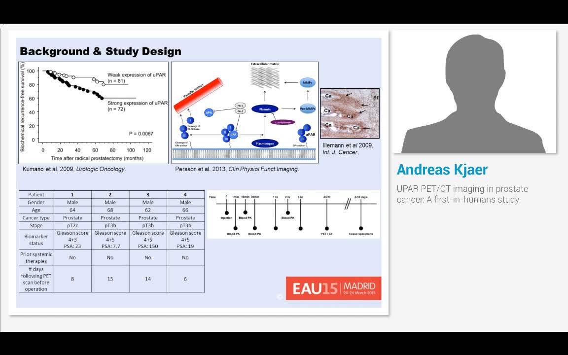 UPAR PET-CT imaging in prostate cancer, A first-in-humans..-