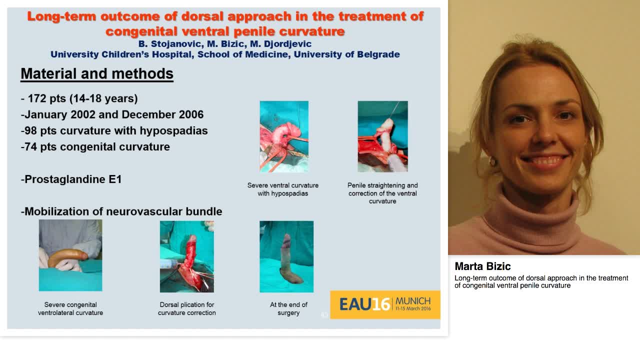 Long-term outcome of dorsal approach in the treatment of -