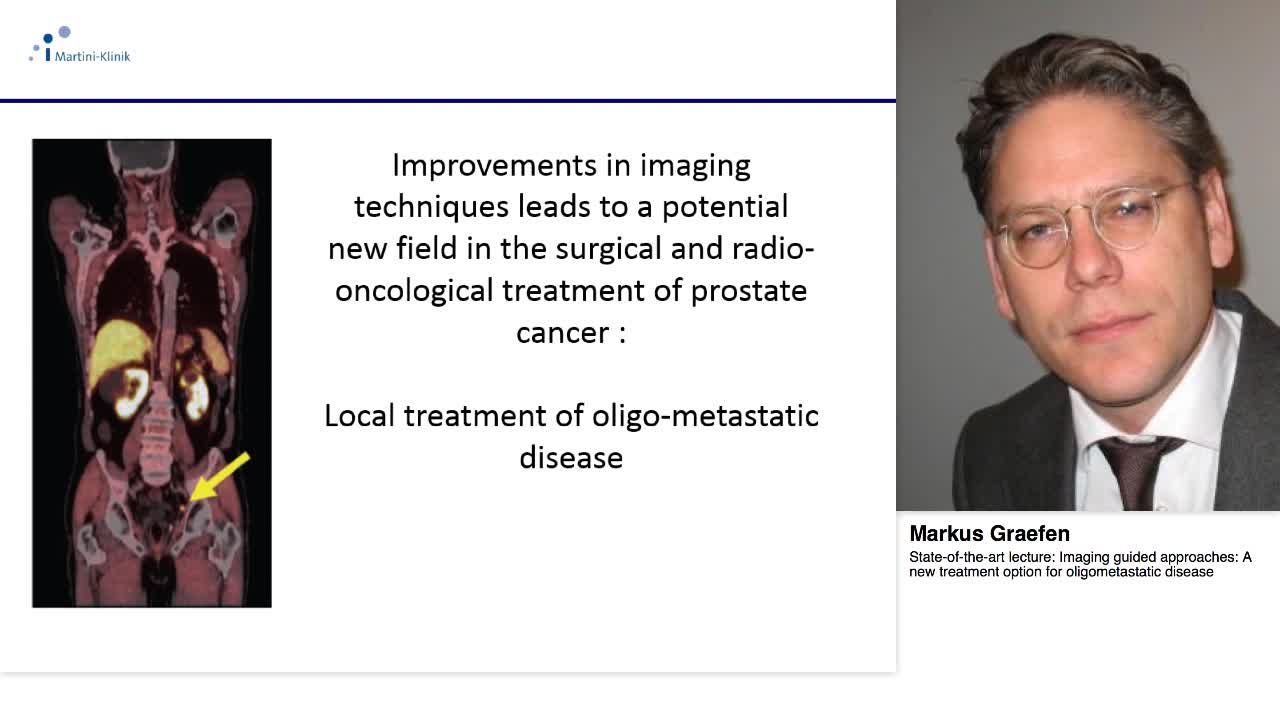 Imaging guided approaches, A new treatment option for oli-