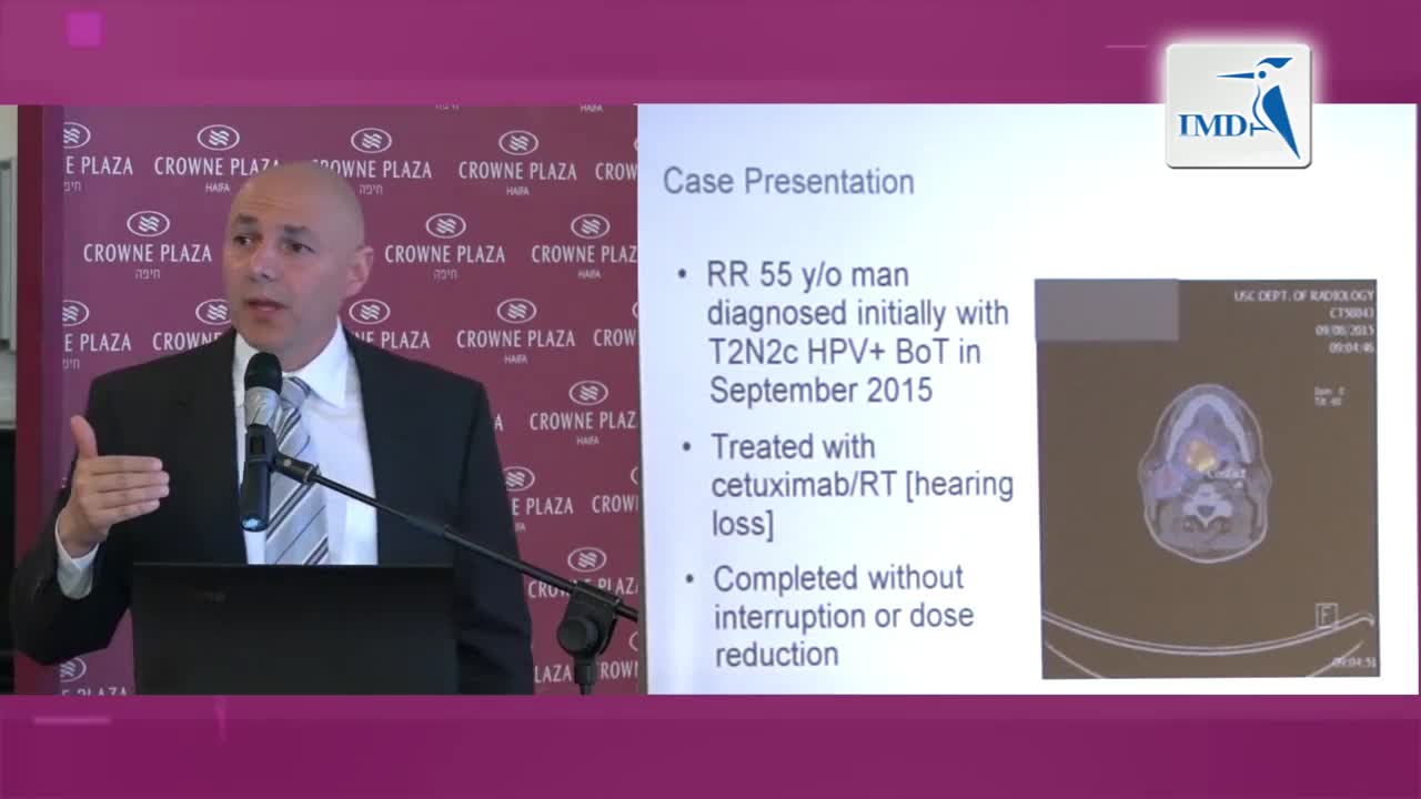 头颈癌免疫疗法 4