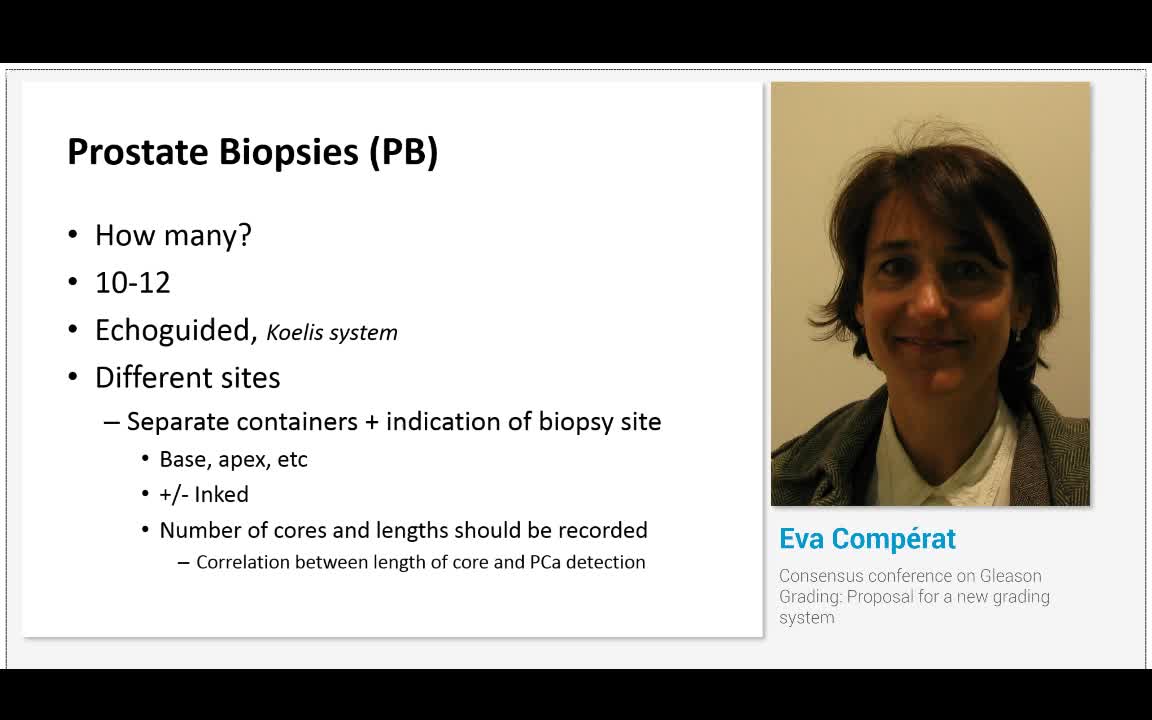 Consensus conference on Gleason Grading, Proposal for a n..-