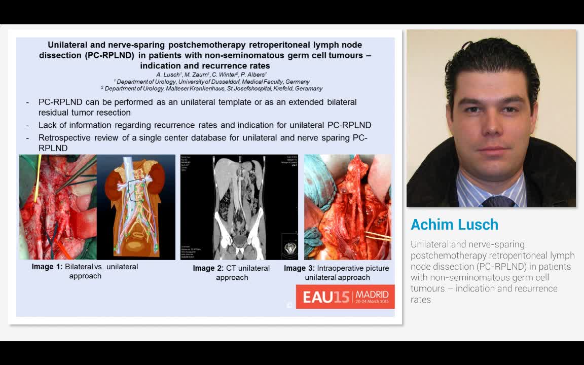 Unilateral and nerve-sparing postchemotherapy retroperito..-