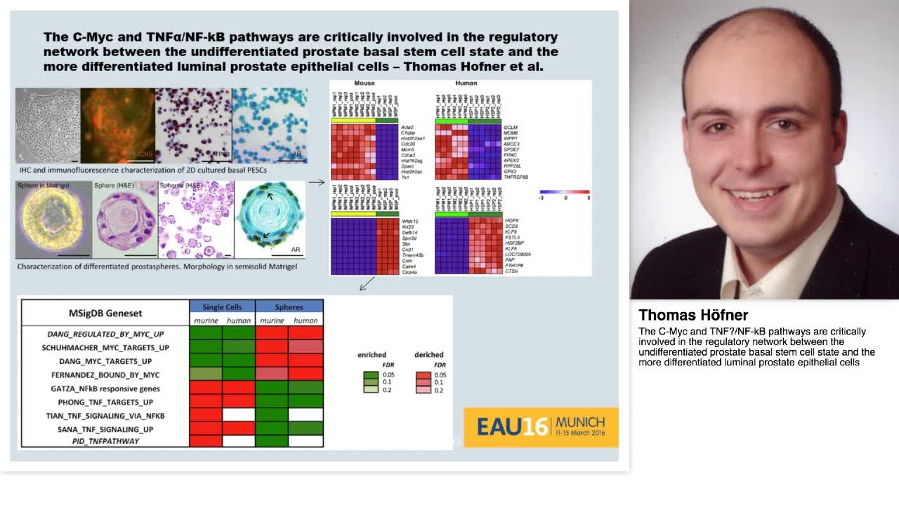 The C-Myc and TNF-NF-kB pathways are critically involved-