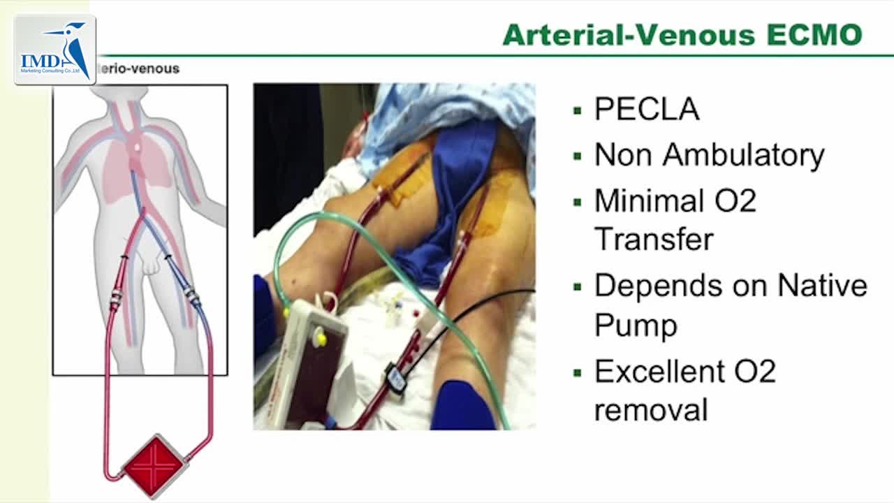 UAB成人体外膜肺氧合计划（3）