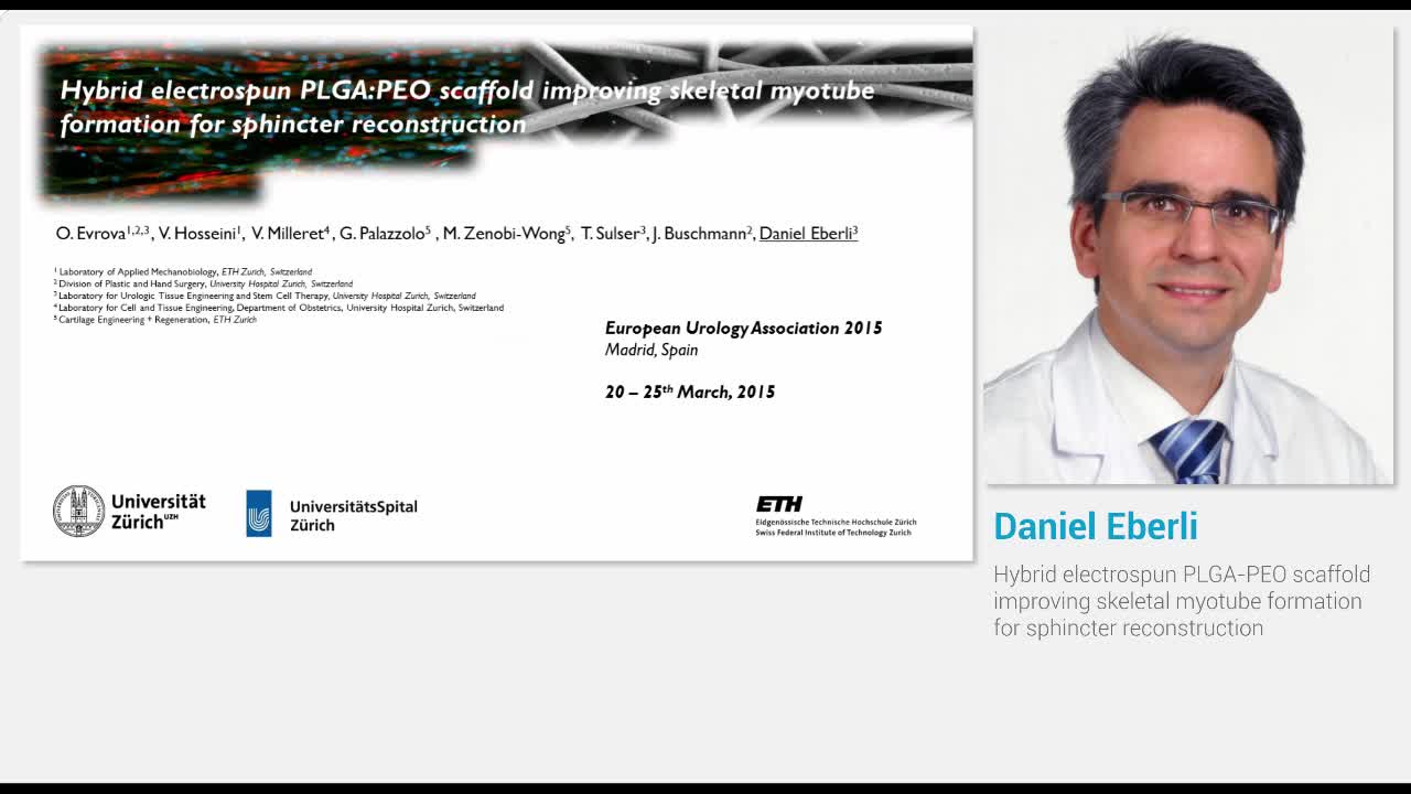 Hybrid electrospun PLGA-PEO scaffold improving skeletal m..-