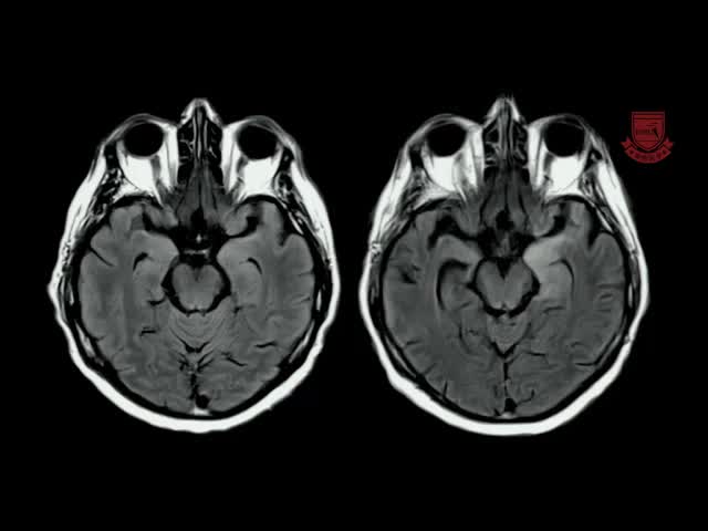 基于案例的神经影像学方法6