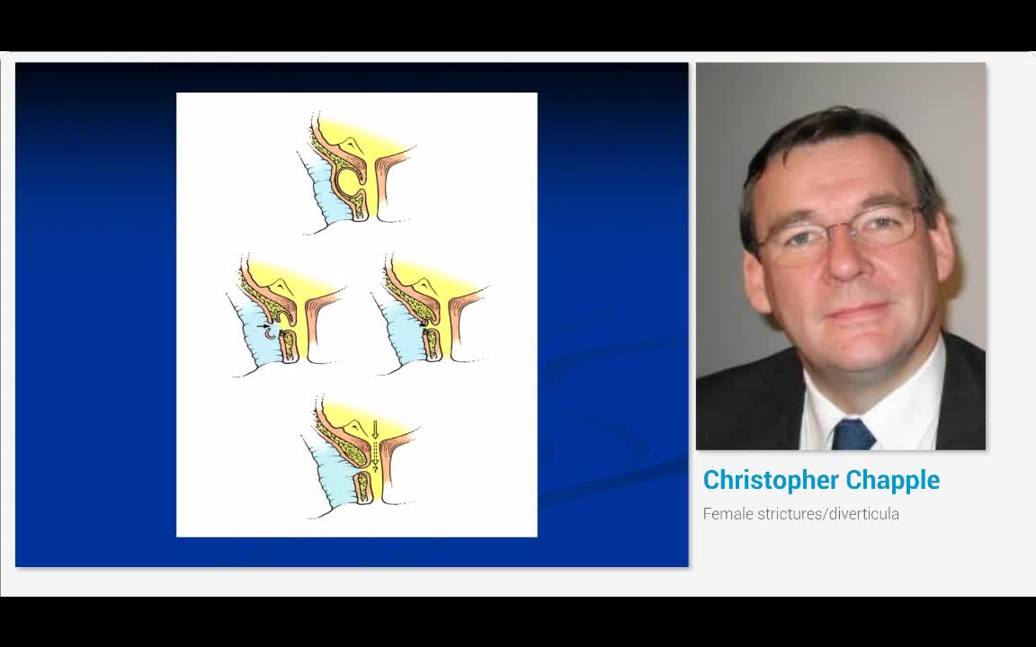 Female strictures-diverticula