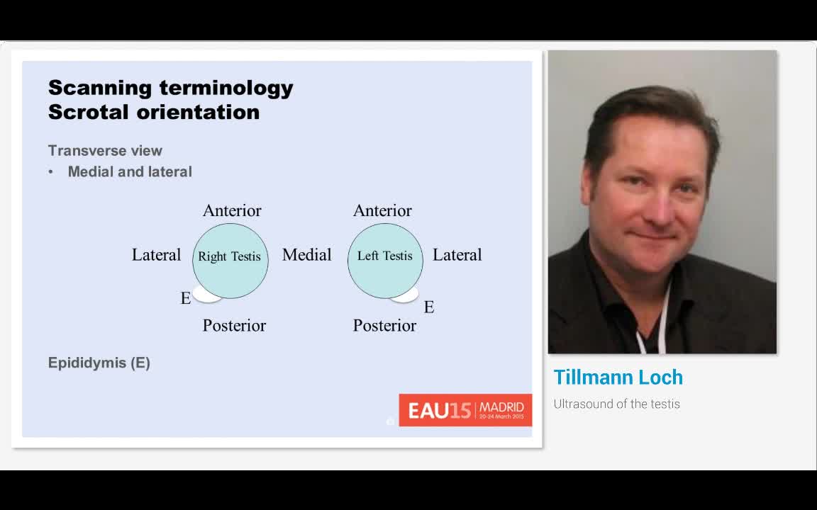 Ultrasound of the testis