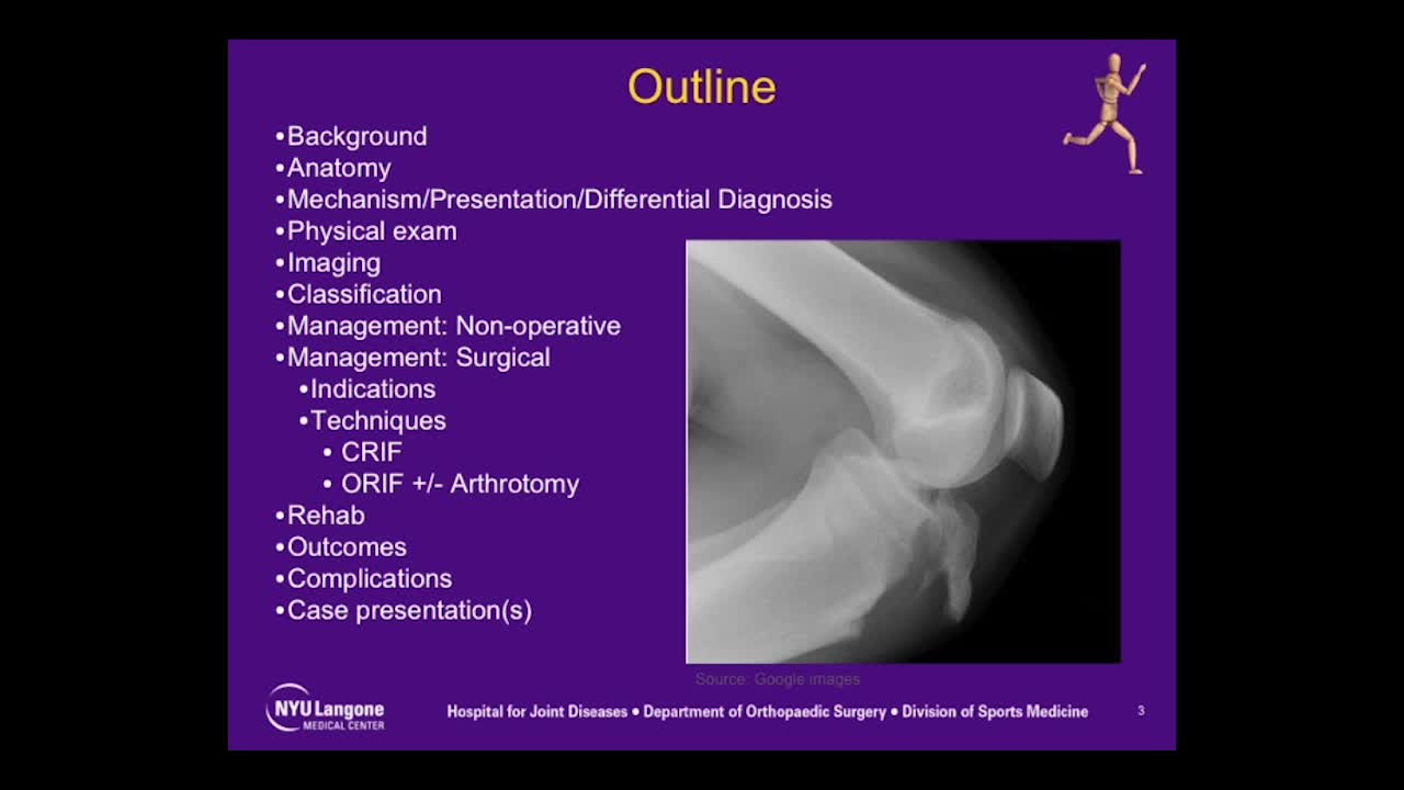 Tibial Tubercle Avulsions lndications and Techniques