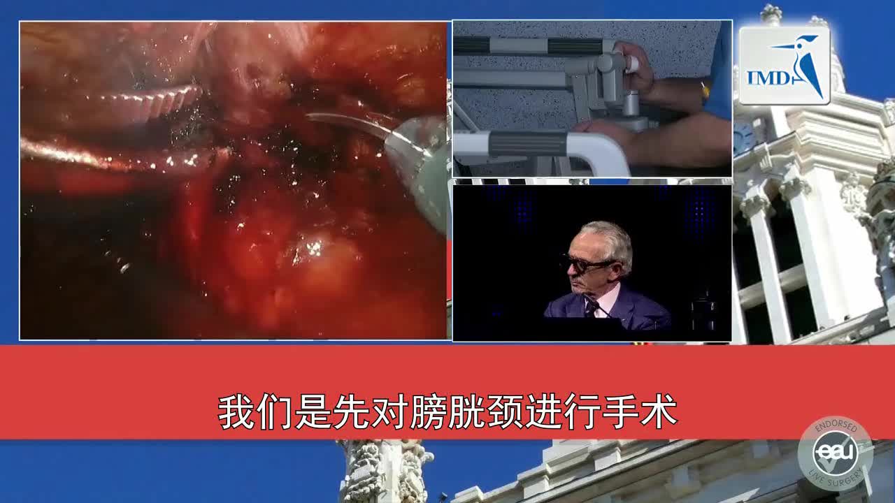 神经保留根治性前列腺切除术（2）