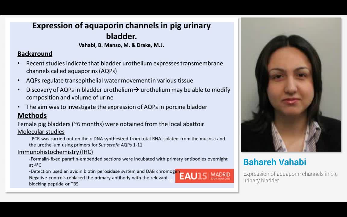 Expression of aquaporin channels in pig urinary bladder