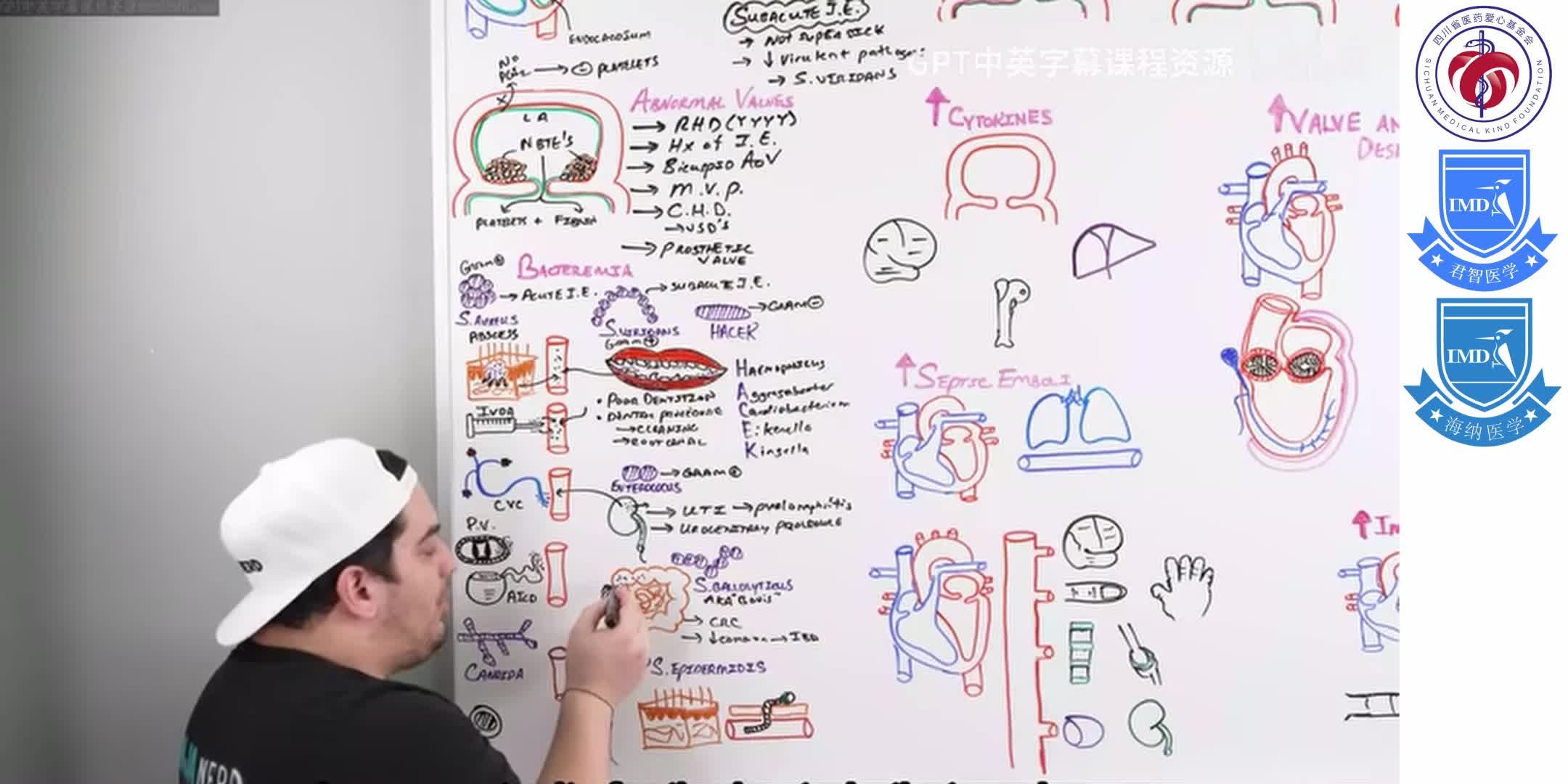Infective Endocarditis 3
