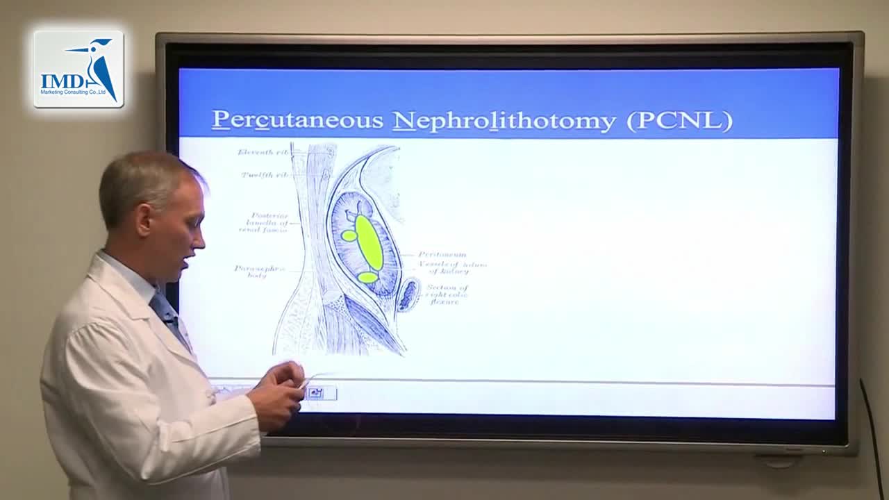治疗肾结石的最新进步和发展（5）