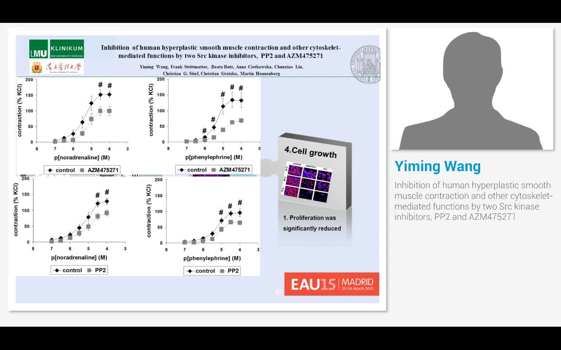 Inhibition of human hyperplastic smooth muscle contractio..-