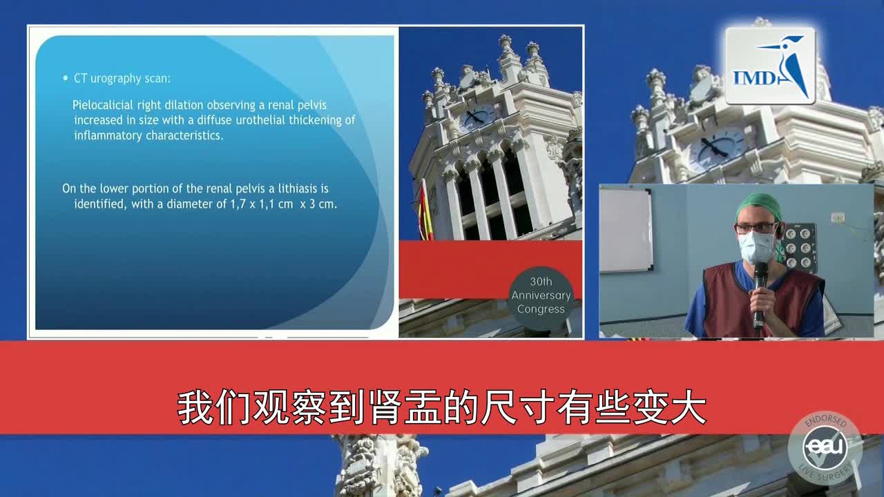 数字技术在肾结石手术中的运用（1）