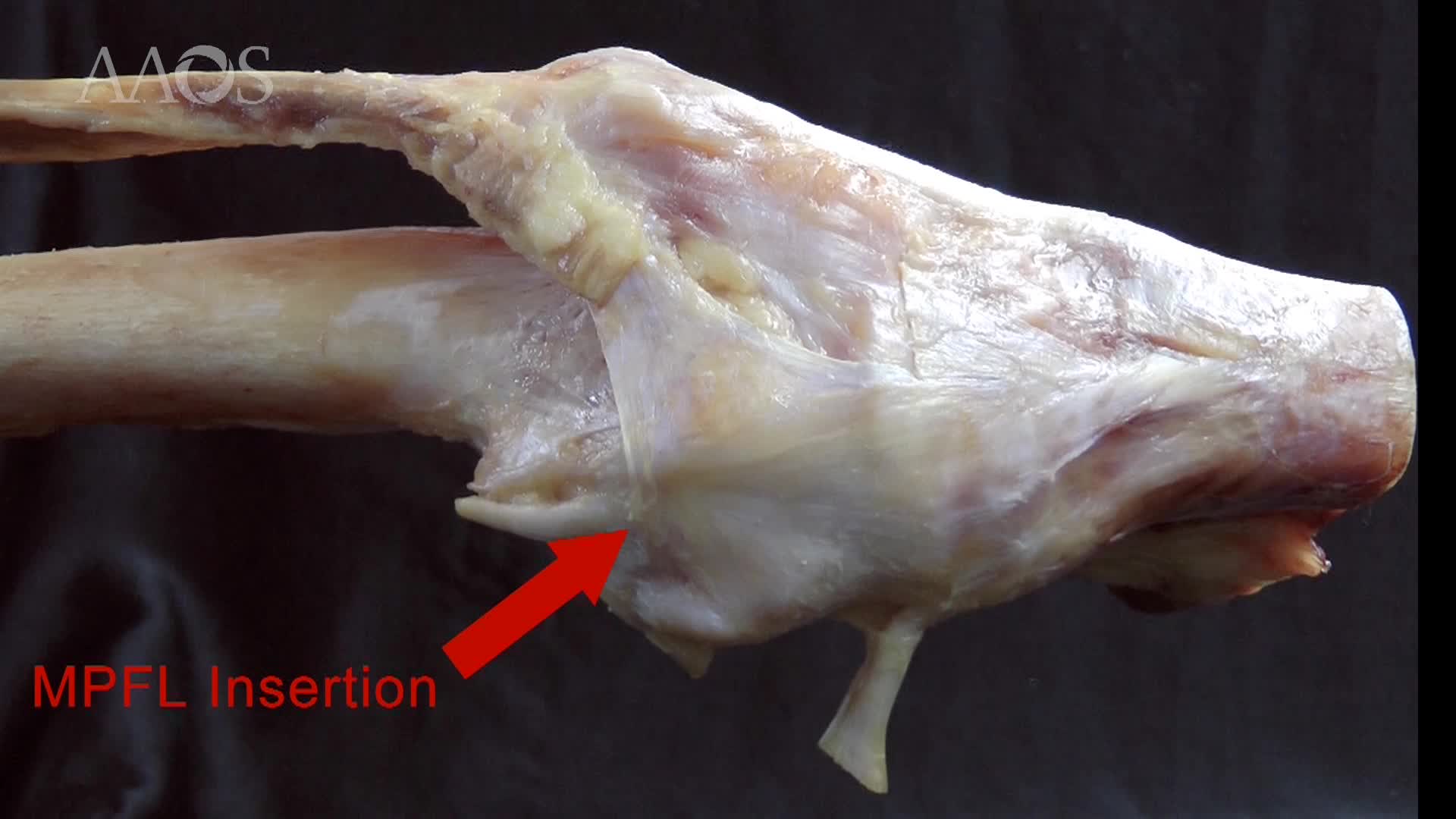 3D Anatomy of the Knee Camillieri G.Golano P.Zaffagnini s.