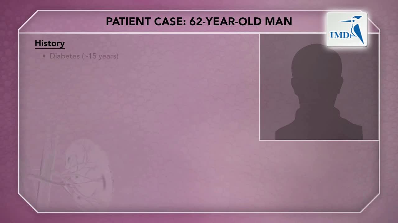 慢性肾病和糖尿病患者的高钾血症（2）