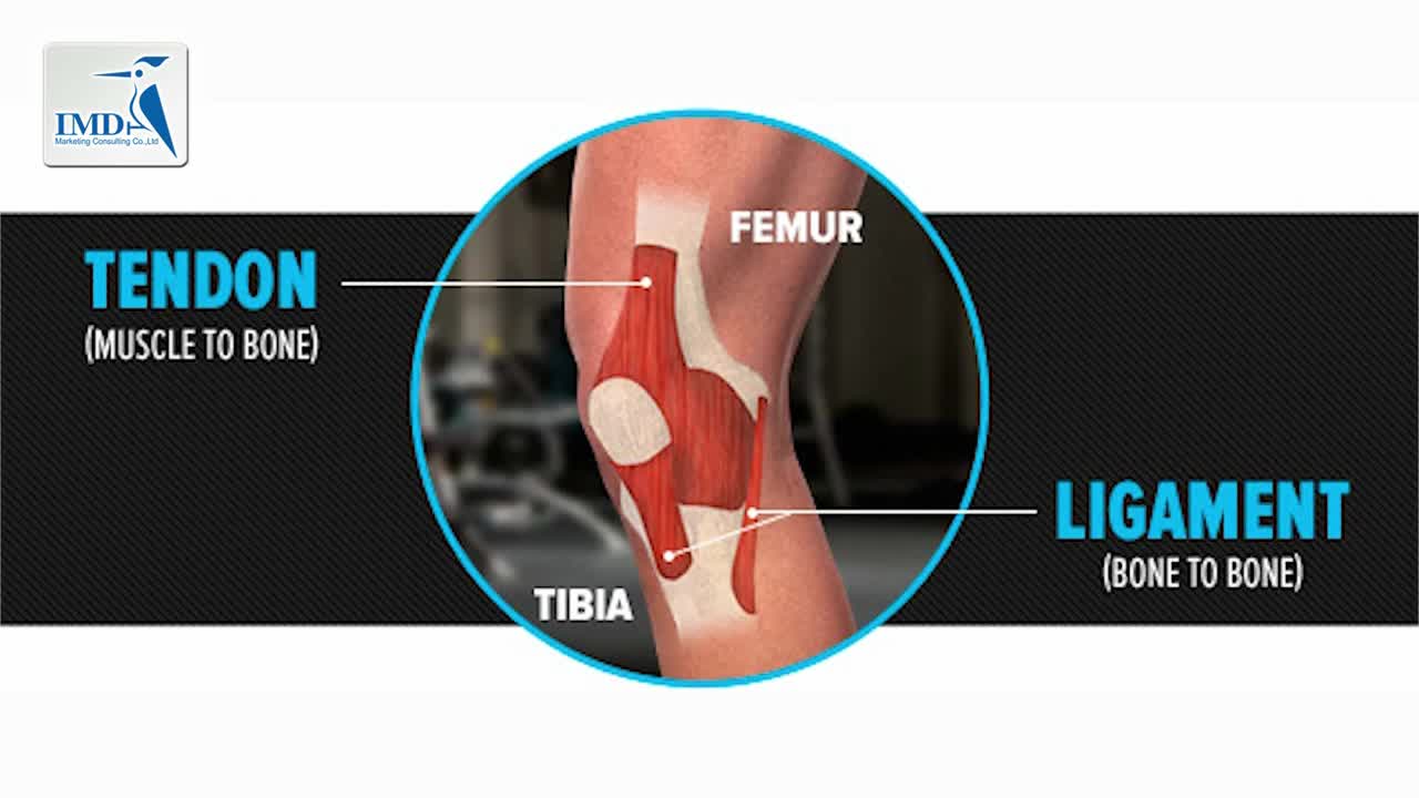 慢性肌腱炎的治疗进展