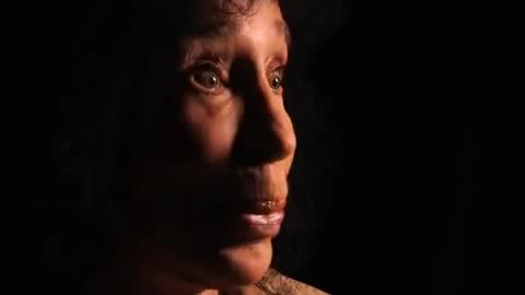 骨科外科手术患者--Claire