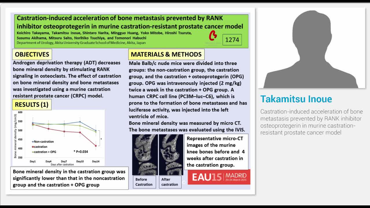 Castration-induced acceleration of bone metastasis preven..-