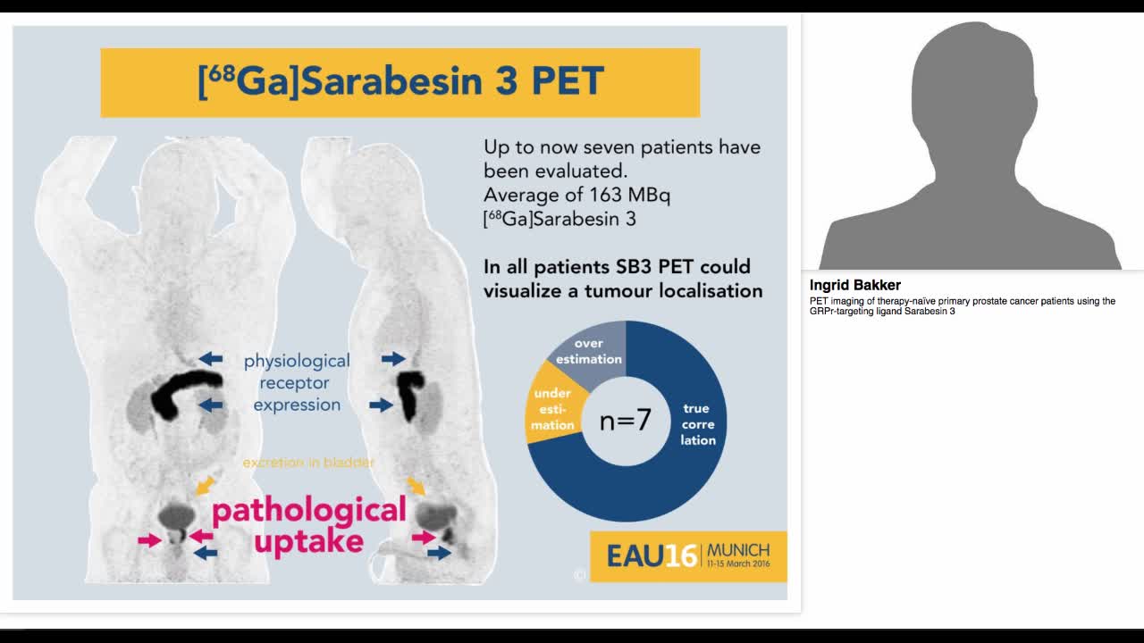 PET imaging of therapy-na&iuml;ve primary prostate cancer pati-