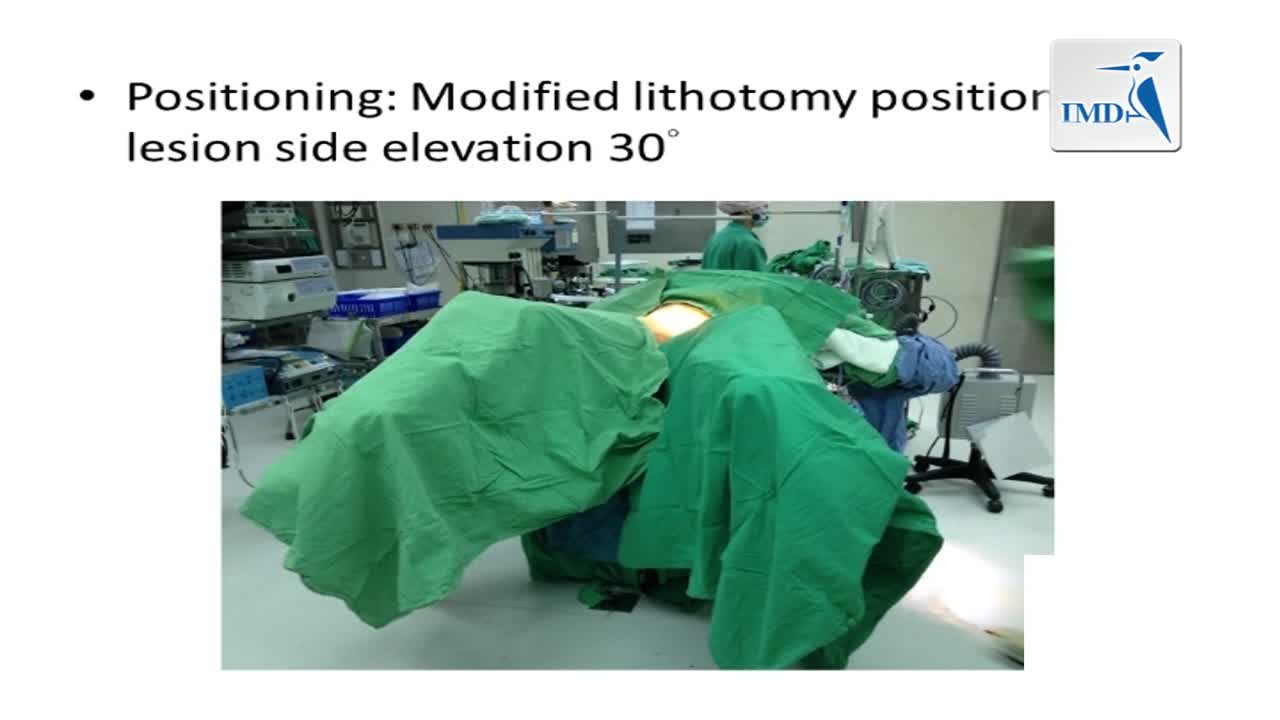 输尿管肾切除术治疗上尿路膀胱上皮癌